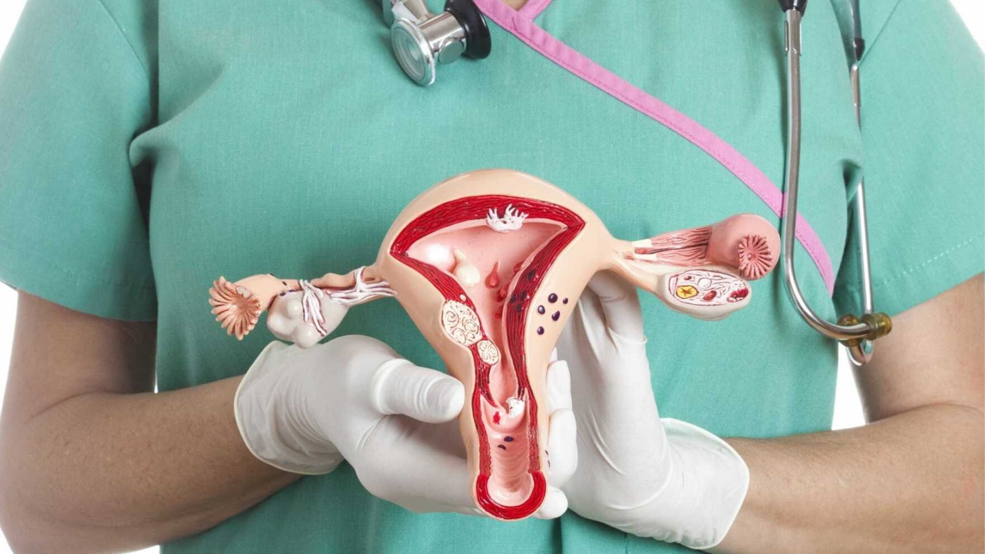 hysteroscopy bladder image shows doctor
